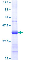 TREX1 Protein - 12.5% SDS-PAGE Stained with Coomassie Blue.