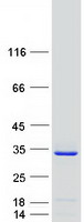 TREX2 Protein - Purified recombinant protein TREX2 was analyzed by SDS-PAGE gel and Coomassie Blue Staining