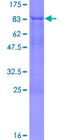 TRF1 / TERF1 Protein - 12.5% SDS-PAGE of human TERF1 stained with Coomassie Blue
