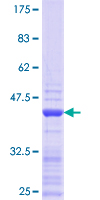 TRF1 / TERF1 Protein - 12.5% SDS-PAGE Stained with Coomassie Blue.