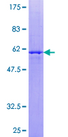 TRH Protein - 12.5% SDS-PAGE of human TRH stained with Coomassie Blue