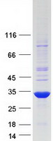 TRH Protein - Purified recombinant protein TRH was analyzed by SDS-PAGE gel and Coomassie Blue Staining