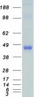 TRIB1 Protein - Purified recombinant protein TRIB1 was analyzed by SDS-PAGE gel and Coomassie Blue Staining
