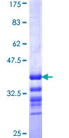 TRIB2 Protein - 12.5% SDS-PAGE Stained with Coomassie Blue.