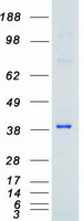 TRIB2 Protein - Purified recombinant protein TRIB2 was analyzed by SDS-PAGE gel and Coomassie Blue Staining