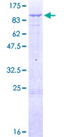 TRIM1 / MID2 Protein - 12.5% SDS-PAGE of human MID2 stained with Coomassie Blue