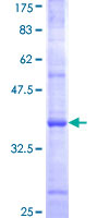 TRIM1 / MID2 Protein - 12.5% SDS-PAGE Stained with Coomassie Blue.