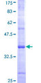 TRIM1 / MID2 Protein - 12.5% SDS-PAGE Stained with Coomassie Blue.