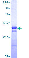 TRIM10 Protein - 12.5% SDS-PAGE Stained with Coomassie Blue.