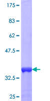 TRIM11 Protein - 12.5% SDS-PAGE Stained with Coomassie Blue.