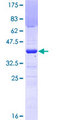 TRIM13 Protein - 12.5% SDS-PAGE Stained with Coomassie Blue.
