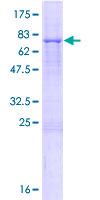 TRIM14 Protein - 12.5% SDS-PAGE of human TRIM14 stained with Coomassie Blue