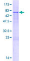 TRIM14 Protein - 12.5% SDS-PAGE of human TRIM14 stained with Coomassie Blue