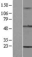 TRIM15 Protein - Western validation with an anti-DDK antibody * L: Control HEK293 lysate R: Over-expression lysate