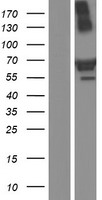 TRIM16 Protein - Western validation with an anti-DDK antibody * L: Control HEK293 lysate R: Over-expression lysate