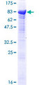 TRIM16 Protein - 12.5% SDS-PAGE of human TRIM16 stained with Coomassie Blue
