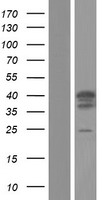 TRIM17 / RNF16 Protein - Western validation with an anti-DDK antibody * L: Control HEK293 lysate R: Over-expression lysate