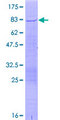TRIM17 / RNF16 Protein - 12.5% SDS-PAGE of human TRIM17 stained with Coomassie Blue