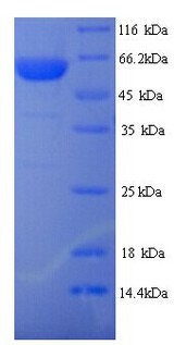 TRIM21 / RO52 Protein