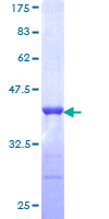 TRIM21 / RO52 Protein - 12.5% SDS-PAGE Stained with Coomassie Blue.