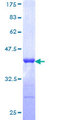 TRIM21 / RO52 Protein - 12.5% SDS-PAGE Stained with Coomassie Blue.