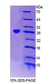 TRIM21 / RO52 Protein - Recombinant Sjogren Syndrome Antigen A1 (SSA1) by SDS-PAGE