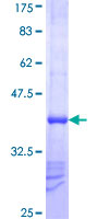TRIM23 Protein - 12.5% SDS-PAGE Stained with Coomassie Blue.