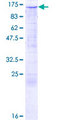 TRIM24 / TIF1 Protein - 12.5% SDS-PAGE of human TRIM24 stained with Coomassie Blue