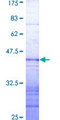 TRIM24 / TIF1 Protein - 12.5% SDS-PAGE Stained with Coomassie Blue.