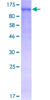 TRIM28 / KAP1 Protein - 12.5% SDS-PAGE of human TRIM28 stained with Coomassie Blue