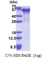 TRIM28 / KAP1 Protein