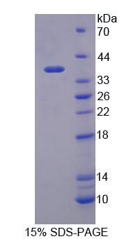 TRIM28 / KAP1 Protein - Recombinant Transcriptional Intermediary Factor 1 Beta (TIF1b) by SDS-PAGE