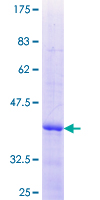 TRIM29 Protein - 12.5% SDS-PAGE Stained with Coomassie Blue.