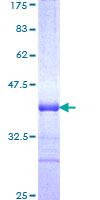 TRIM31 / RNF Protein - 12.5% SDS-PAGE Stained with Coomassie Blue
