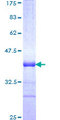 TRIM31 / RNF Protein - 12.5% SDS-PAGE Stained with Coomassie Blue