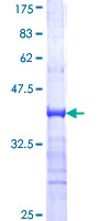 TRIM33 / TIF1-Gamma Protein - 12.5% SDS-PAGE Stained with Coomassie Blue.