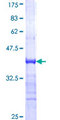 TRIM33 / TIF1-Gamma Protein - 12.5% SDS-PAGE Stained with Coomassie Blue.
