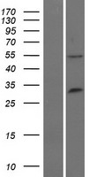 TRIM34 / RNF21 Protein - Western validation with an anti-DDK antibody * L: Control HEK293 lysate R: Over-expression lysate