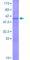 TRIM34 / RNF21 Protein - 12.5% SDS-PAGE of human TRIM34 stained with Coomassie Blue