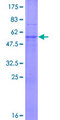 TRIM34 / RNF21 Protein - 12.5% SDS-PAGE of human TRIM34 stained with Coomassie Blue