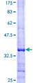 TRIM34 / RNF21 Protein - 12.5% SDS-PAGE Stained with Coomassie Blue.