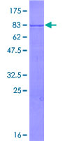 TRIM35 Protein - 12.5% SDS-PAGE of human TRIM35 stained with Coomassie Blue