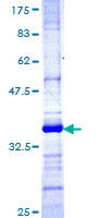 TRIM35 Protein - 12.5% SDS-PAGE Stained with Coomassie Blue.