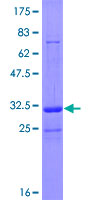 TRIM36 Protein - 12.5% SDS-PAGE of human TRIM36 stained with Coomassie Blue