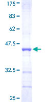 TRIM36 Protein - 12.5% SDS-PAGE Stained with Coomassie Blue.