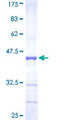 TRIM36 Protein - 12.5% SDS-PAGE Stained with Coomassie Blue.