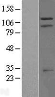 TRIM37 / TEF3 Protein - Western validation with an anti-DDK antibody * L: Control HEK293 lysate R: Over-expression lysate