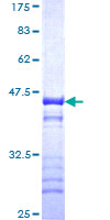 TRIM37 / TEF3 Protein - 12.5% SDS-PAGE Stained with Coomassie Blue.