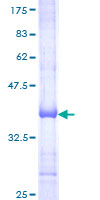 TRIM38 Protein - 12.5% SDS-PAGE Stained with Coomassie Blue.