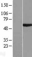 TRIM39 / RNF23 Protein - Western validation with an anti-DDK antibody * L: Control HEK293 lysate R: Over-expression lysate
